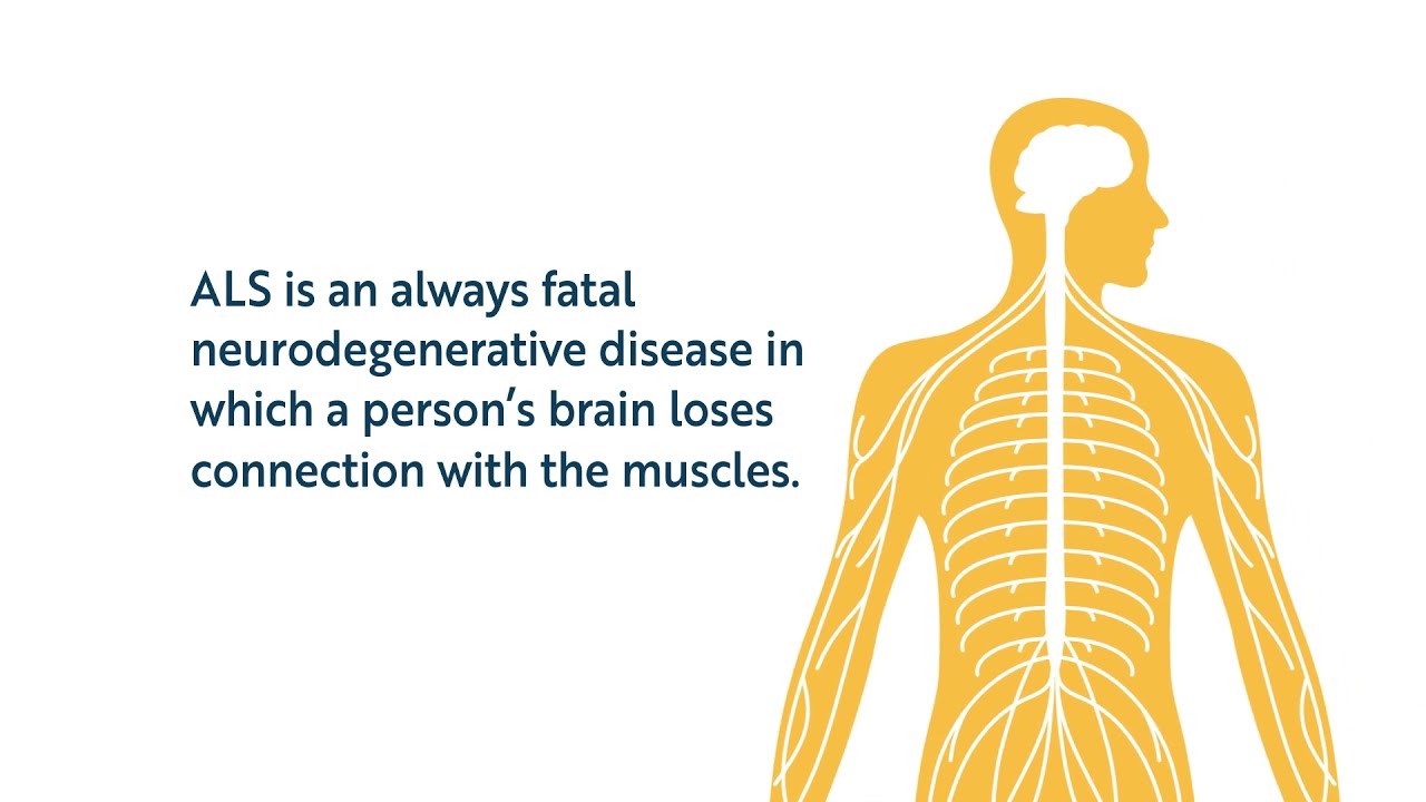 Infographic indicating ALS is always lethal.